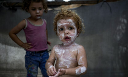 APTOPIX Israel Palestinians Skin Diseases