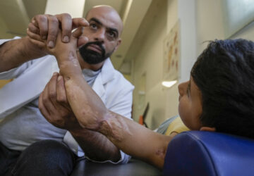 Adam Afana, 5, who was brought to Lebanon from the Strip for treatment after he nearly lost his left arm in an Israeli airstrike that killed his father and sister, receives physiotherapy at a clinic in Mar Elias Palestinian refugee camp in Beirut, Lebanon, Wednesday, Sept. 4, 2024. (AP Photo/Bilal Hussein)