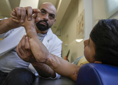 Adam Afana, 5, who was brought to Lebanon from the Strip for treatment after he nearly lost his left arm in an Israeli airstrike that killed his father and sister, receives physiotherapy at a clinic in Mar Elias Palestinian refugee camp in Beirut, Lebanon, Wednesday, Sept. 4, 2024. (AP Photo/Bilal Hussein)