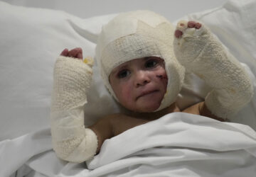 FILE - A Lebanese child with burns over 40 percent of her body following an Israeli airstrike in September near their home in Deir Qanoun al Nahr, lies on a hospital bed in Beirut, Lebanon, on Oct. 29, 2024. (AP Photo/Hussein Malla, File)