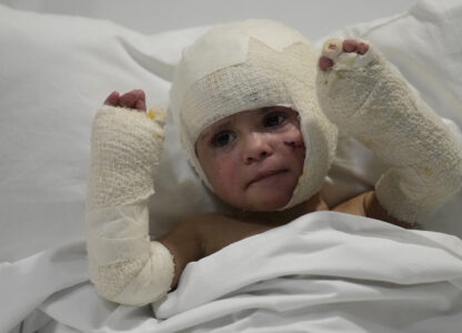 FILE - A Lebanese child with burns over 40 percent of her body following an Israeli airstrike in September near their home in Deir Qanoun al Nahr, lies on a hospital bed in Beirut, Lebanon, on Oct. 29, 2024. (AP Photo/Hussein Malla, File)